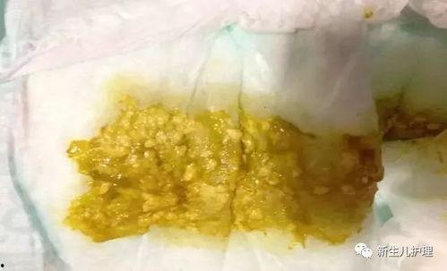 宝宝吃哈密瓜拉肚子吗